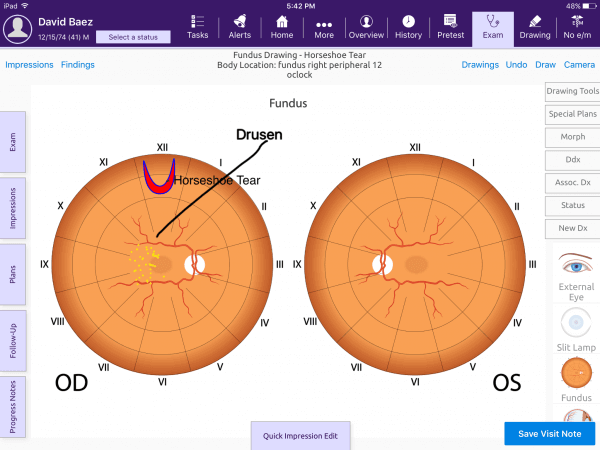 electronic-medical-assistant-Ophthalmology-res